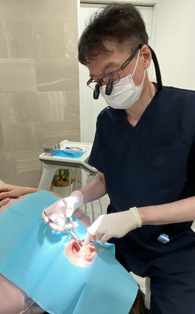 抜歯